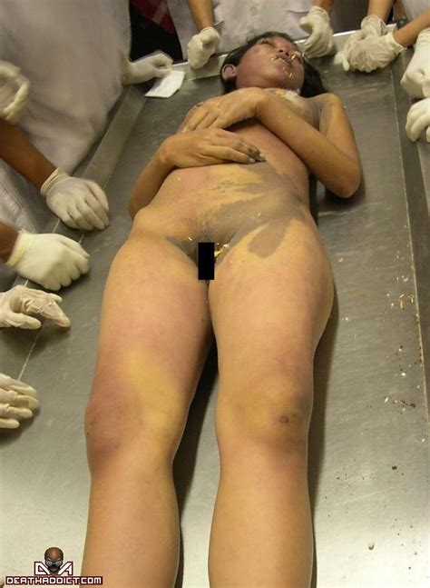 Naked Girl Autopsy Hot Sex Picture
