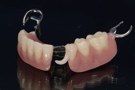 Partial Denture Bottom Front Teeth