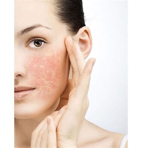 Is Your Skin Sensitive Or Sensitized The Banwell Clinic