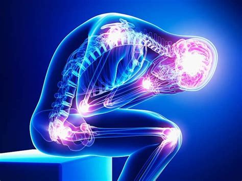 What Is Nerve Neuropathic Pain Positive Life