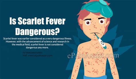 What Is Scarlet Fever Group A Streptococcus Infections