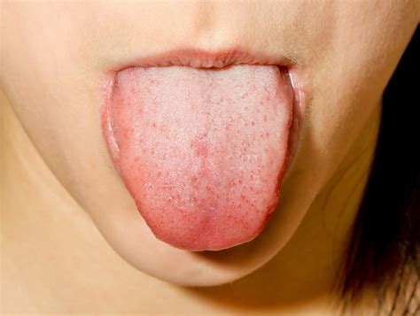Tongue | The-Health-Focus