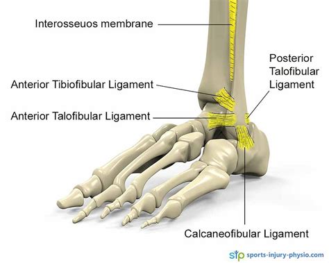 Ankle Sprains Diagnosis Sports Injury Physio