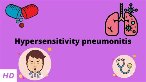 Hypersensitivity Pneumonitis Causes Signs And Symptoms Diagnosis And