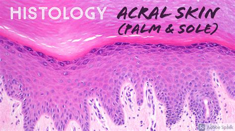 Skin Histology Acral Skin Aka Glabrous Skin Of Palm Of Hand Sole Of