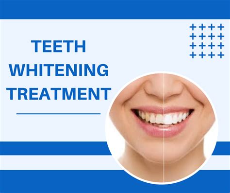 A Brighter Smile The Ultimate Guide To Teeth Whitening