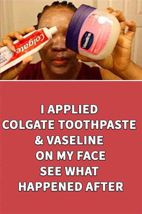 I Applied Colgate Toothpaste Vaseline On My Face See What Happened