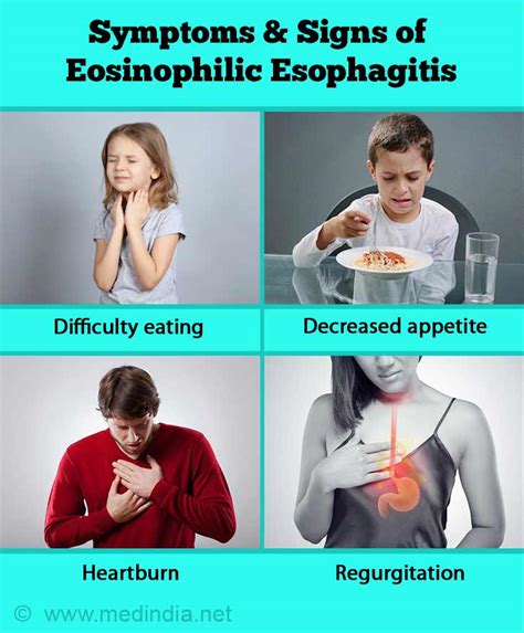 Eosinophilic Esophagitis Eoe Allergic Esophagitis Causes