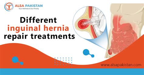 Different Inguinal Hernia Repair Treatments