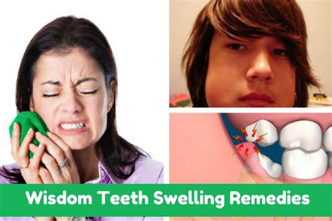 To use tea bags as a a wisdom tooth may be removed in a dental surgery by a dentist or in a hospital by a dental surgeon. Read the Wisdom Teeth Swelling Remedies guide. Check ...