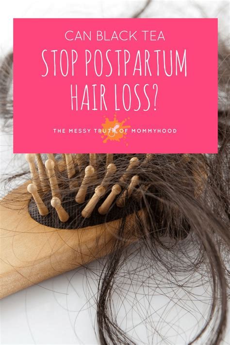 The Balding And The Beautiful A Follow Up Postpartum Hair Loss Hair