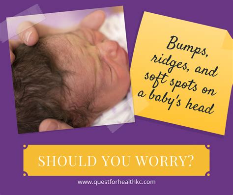 Bumps Ridges And Soft Spots On A Babys Head When Should You Worry