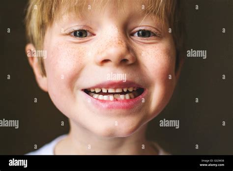 One Tooth Missing Hi Res Stock Photography And Images Alamy