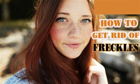 How To Get Rid Of Freckles On Face 10 Home Remedies Getting Rid Of