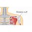 Rotator Cuff Related Shoulder Pain  Bassendean Physiotherapy