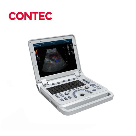 Contec Cms1700b Dispositivo De Diagnóstico Ultrasónico Doppler Color B