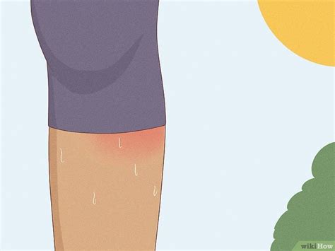 13 Common Causes Behind Itchy Legs And How To Treat Itchiness