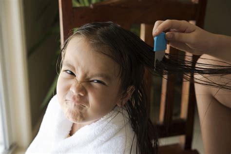 Why You Cant Get Rid Of Lice When You Have Tried Everything Licedoctors