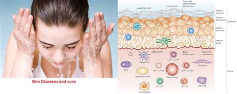 Skin Diseases And Cure Dry Skin And Darkening Treatment