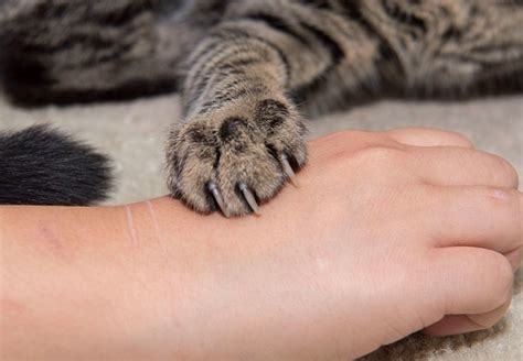 Cat Scratch Disease Important Information For Cat Owner