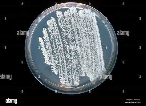 Candida Albicans From Sputum Stock Photo Alamy