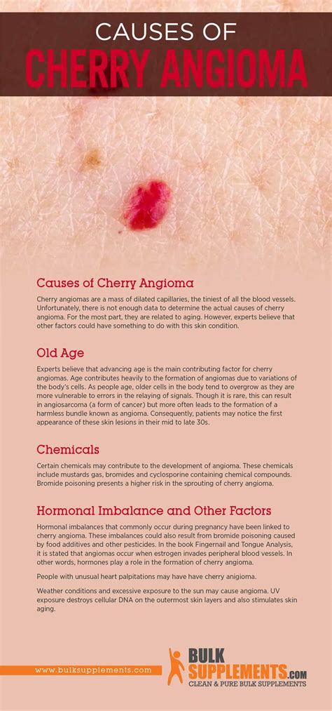 Cherry Angioma Characteristics Causes And Treatment