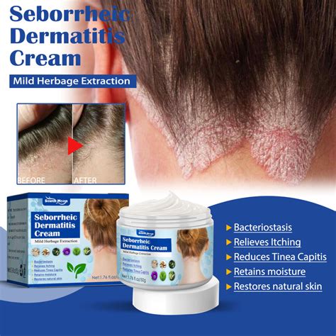 50g South Moon Eczema Treatment Cream，psoriasis Ointment Eczema