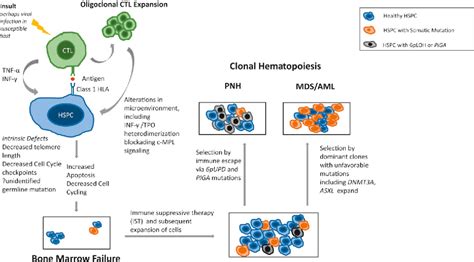 Figure 1 From The Pathophysiology Of Acquired Aplastic Anemia Current