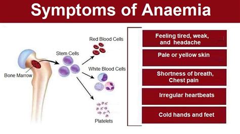 Symptoms Of Anaemia What Are The Types And Causes Helal Medical