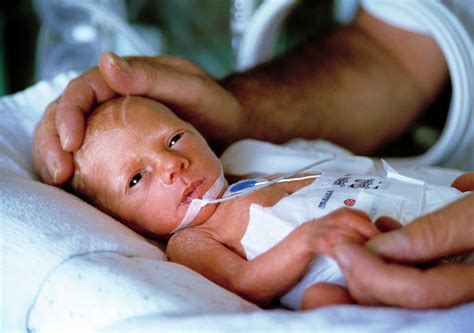 Premature Baby Photograph By John Colescience Photo Library Pixels