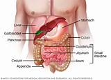 Images of Small Bowel Crohn''s Treatment
