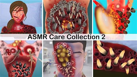 Asmr Care Animation Collection 2 케어 애니메이션 모음집 With Realxing Music