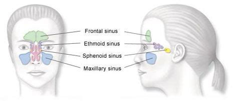 Resultado De Imagen Para Sphenoid Ethmoid Sinuses Sinusitis Treatment