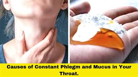 Causes Of Constant Phlegm And Mucus In Your Throat Constantly