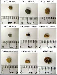How Big Is 1 Centimeter Kidney Stone Healthykidneyclub Com