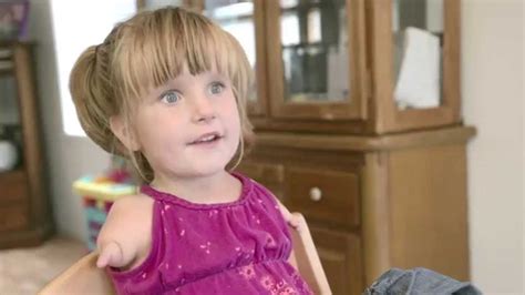 Young Girl Born Without Arms Has Strong Determination And Spirit