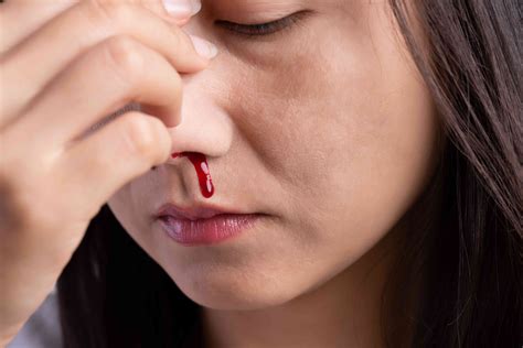 Bleeding Disorder Types Causes And Treatments