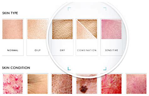 Skin Explained Kawartha Cosmetic Clinic