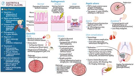 Pathology Gastritis And Peptic Ulcer Disease Ditki Medical
