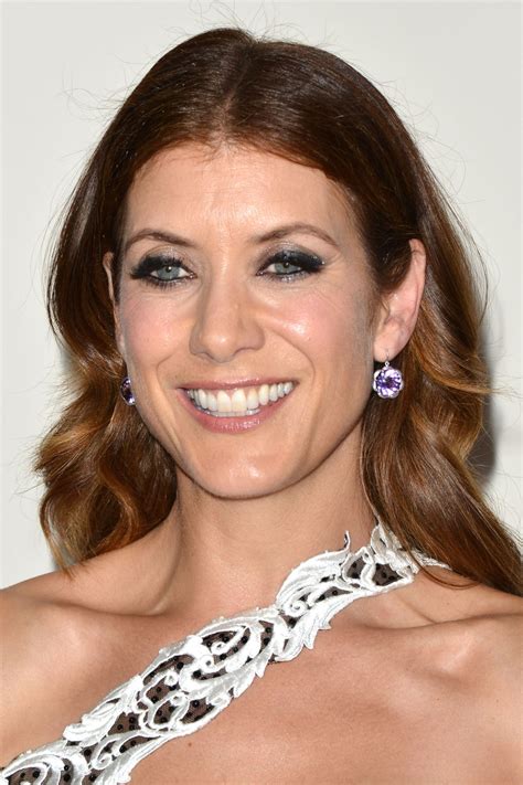 Kate Walsh Operation Smile 2014 Smile Gala In Beverly Hills