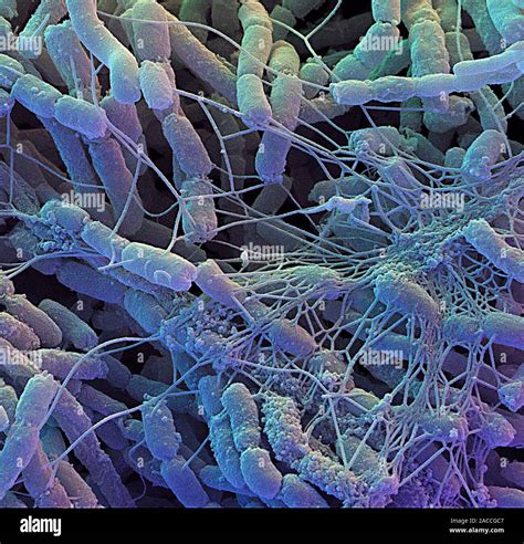 Streptomyces Bacteria Coloured Scanning Electron Micrograph Sem Of