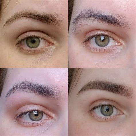 This Redditor Fixed Their Overplucked Eyebrows In Self Isolation — See