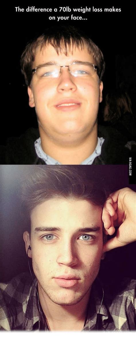 The Difference A 70lb Weight Loss Makes On Your Face