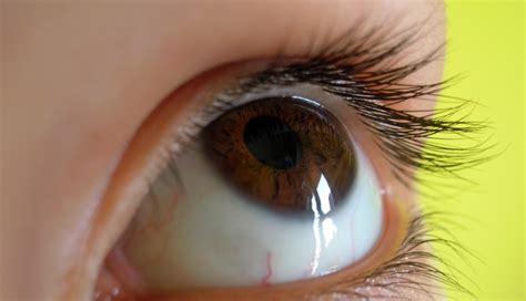 Structural Changes In Eye May Predict Schizophrenia Psychiatry Advisor