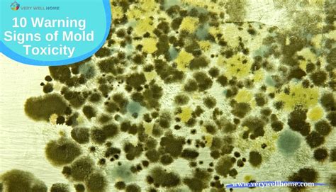 10 Warning Signs Of Mold Toxicity Check Right Now