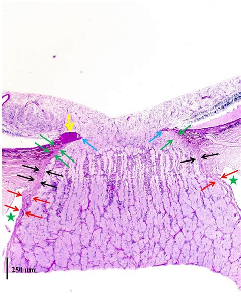 Peripapillary Border Tissue Of The Choroid And Peripapillary Scleral