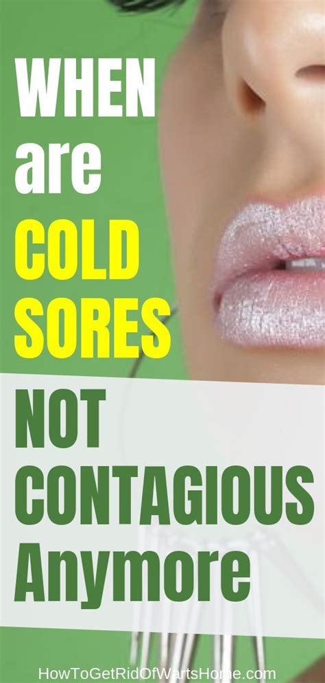 When Are Cold Sores Not Contagious Anymore Cold Sore Fever Blister