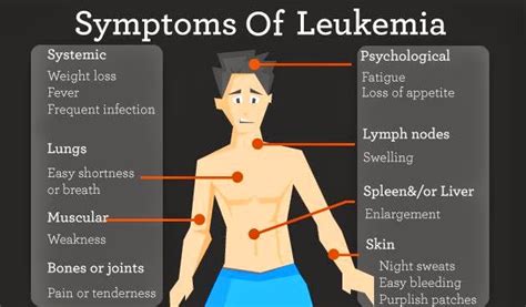 Understanding And Recognizing Leukemia Symptoms