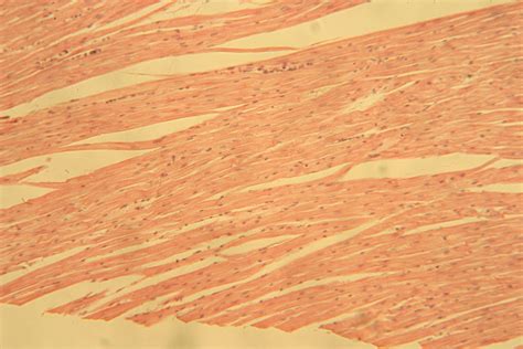 Unlabeled Muscle Images Histology Atlas For Anatomy And Physiology