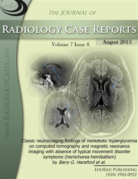 Vol 7 No 8 2013 Free Journal Access Radiology Journal